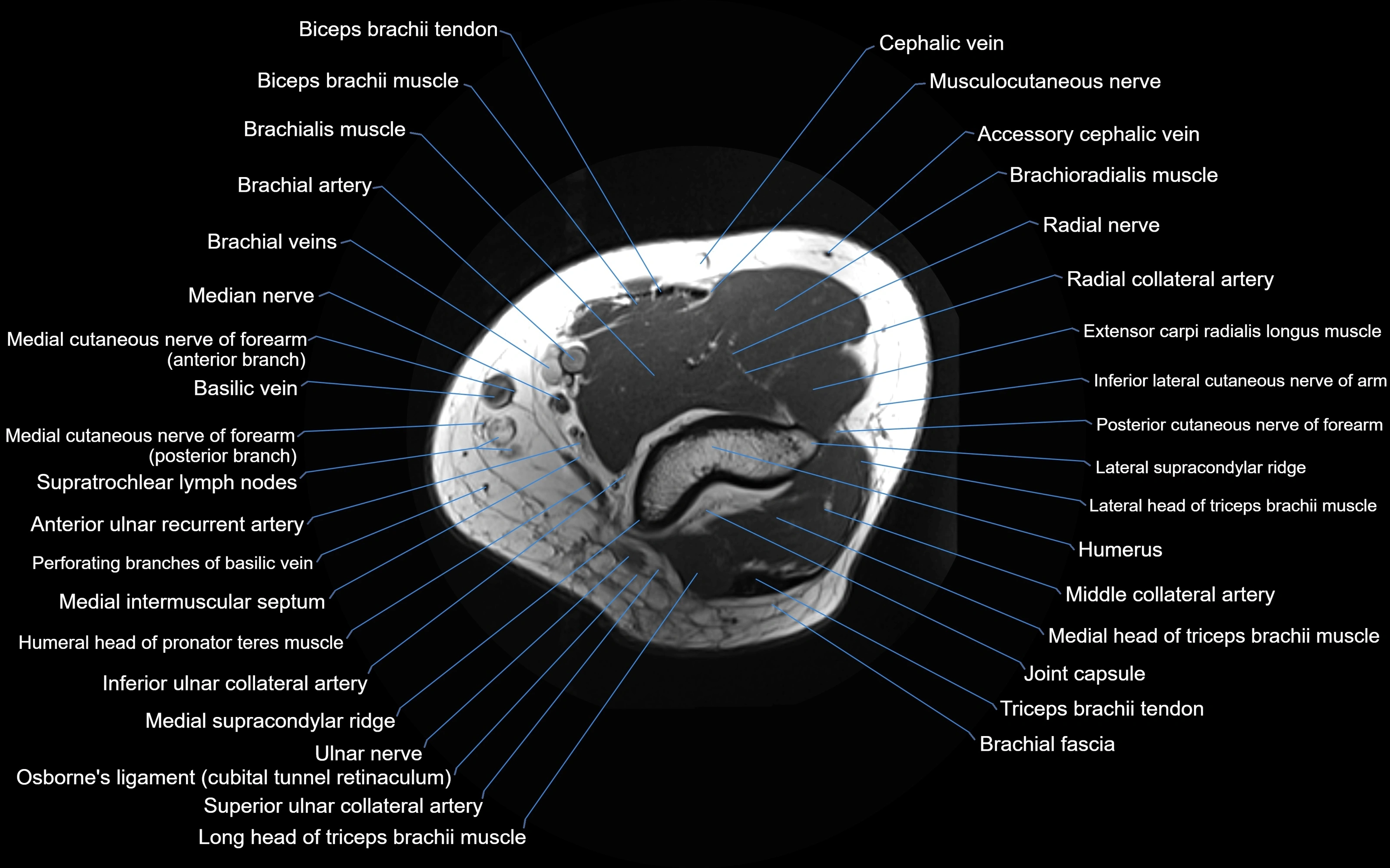 MRI elbow axial cross sectional anatomy 3T  radiology  image-img-00001-00007.webp